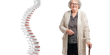 Kadın-Erkek Osteoporoz Tehlikesi: Riskler ve Önlemler