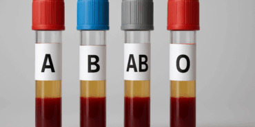 A Kan Grubu: Felç Riskini Artıran Genetik Faktör