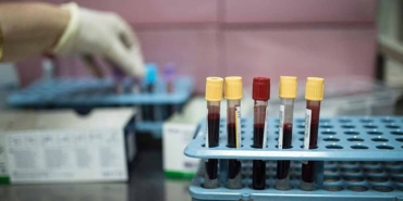 Gençlerde Apandisit Kanseri Artışı Endişe Veriyor