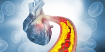 Statinlerin Etkisi: Herkes İçin Gerekli Mi?