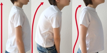 Skolyoz: Erken Teşhisle Sağlıklı Bir Gelecek!