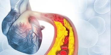 Kolesterol Yanılgıları: LDL Düşman mı, Dost mu?
