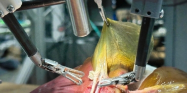 Tam Otonom Cerrahi Robot SRT-H ile Devrim!