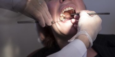 Diş Dolgusu: Sağlıklı Gülüş İçin İpuçları