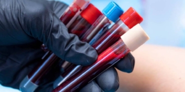 Yeni Kan Grubu Antijeni Tıpta Devrim Yaratıyor!