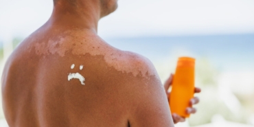 Güneşin Zararı: Deri Kanseri Riski Artıyor!