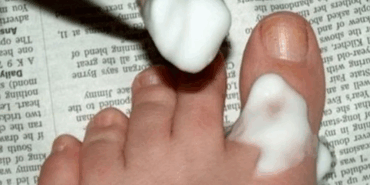 Karbonatla Ayak Bakımı: Doğal Çözüm Yöntemleri