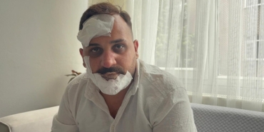 Taksici Serhat Aydemir, polislerce dövüldüğünü iddia etti!