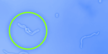 Uçuşan Cisimler: Göz Sağlığınızı Tehdit Ediyor!