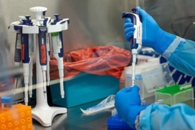 Yeni M Çiçeği Varyantı: Salgın Tehlikesi Kapıda! Yeni M Çiçeği Varyantı: Salgın Tehlikesi Kapıda!