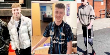 21 Yaşında Sepsisle Hayatı Değişti!