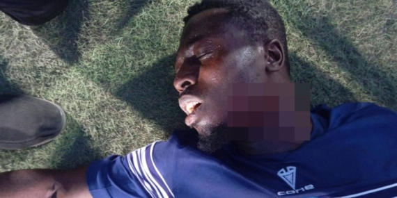 Nijerya’da Futbolcuya Taraftar Saldırısı!