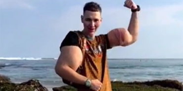 Kirill Tereshin’in Kolları Tehlikede: Amputasyon!