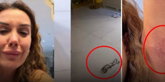 Kardeş Kavgaları: Dilan Polat Darp İddiasında!