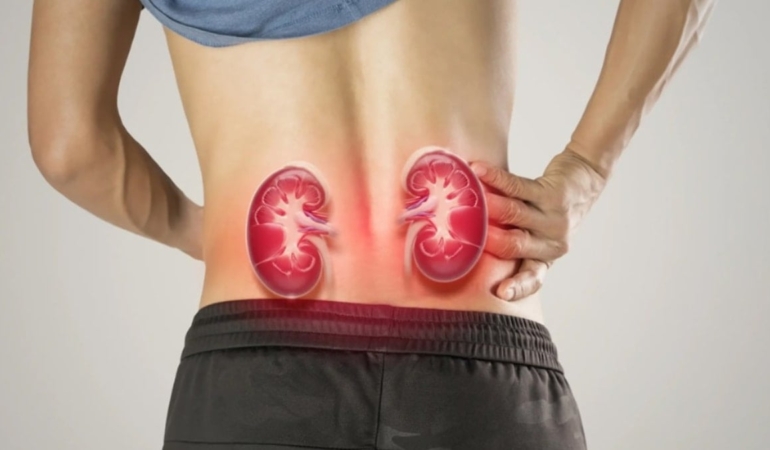 Böbrek Sağlığınıza Zarar Veren 8 Alışkanlık!