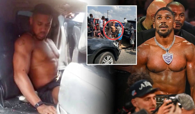 Anthony Joshua Nijerya’da trafik kazası geçirdi!