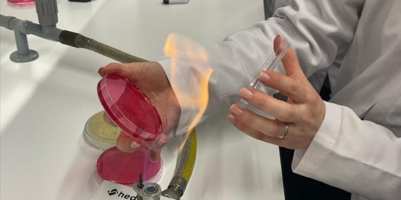 Seramiklerdeki Mikro Çatlaklar Sağlığı Tehdit Ediyor!