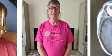 Masum Belirtiler: Hayati Tehlike Taşıyan Tümör