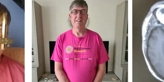 Masum Belirtiler: Hayati Tehlike Taşıyan Tümör