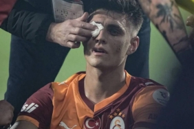 Derbide Çakmak Saldırısı: Taraftar Gözaltında!