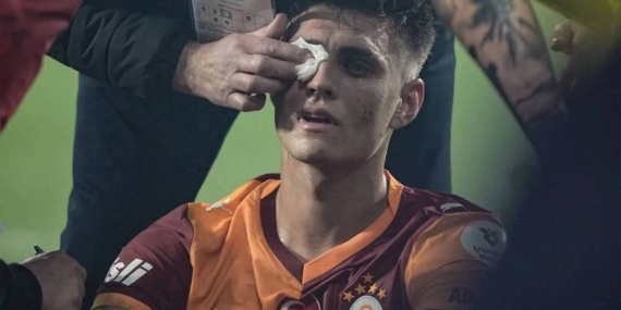 Derbide Çakmak Saldırısı: Taraftar Gözaltında!