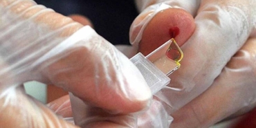 Nadir Kan Grubu Keşfi, Sağlık Sistemini Sarsacak!