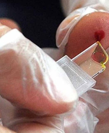 Nadir Kan Grubu Keşfi, Sağlık Sistemini Sarsacak!