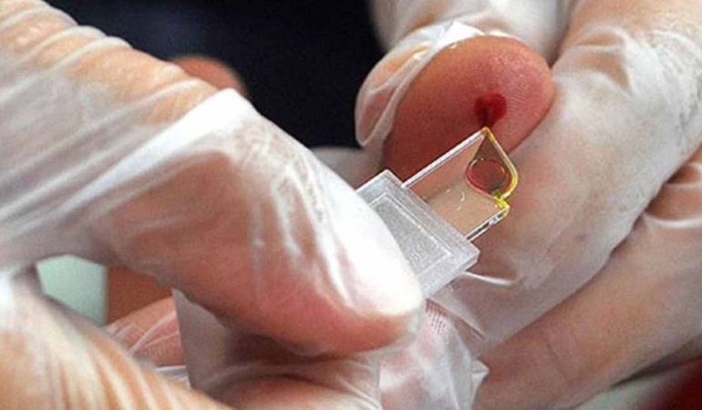 Nadir Kan Grubu Keşfi, Sağlık Sistemini Sarsacak!