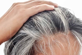 Beyaz Saçlar: Vücudun Koruma Mekanizması mı?