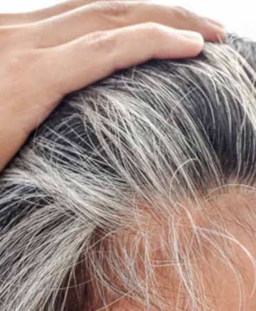 Beyaz Saçlar: Vücudun Koruma Mekanizması mı?