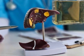 Karaciğer Yağlanmasına Dikkat! Sağlıklı Beslenin!