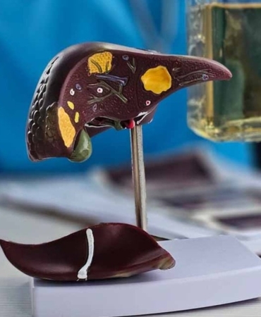 Karaciğer Yağlanmasına Dikkat! Sağlıklı Beslenin!