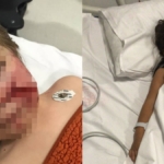 Pitbull Saldırısında İki Çocuk Yaralandı