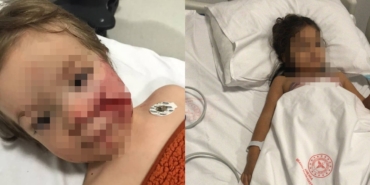 Pitbull Saldırısında İki Çocuk Yaralandı