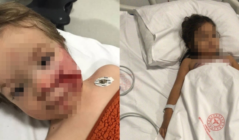 Pitbull Saldırısında İki Çocuk Yaralandı