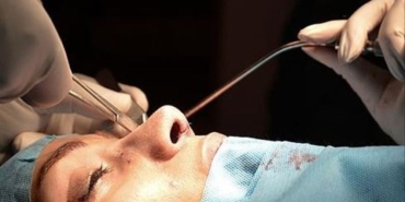 Rinoplasti: Estetik ve Fonksiyonel Cerrahinin Önemi