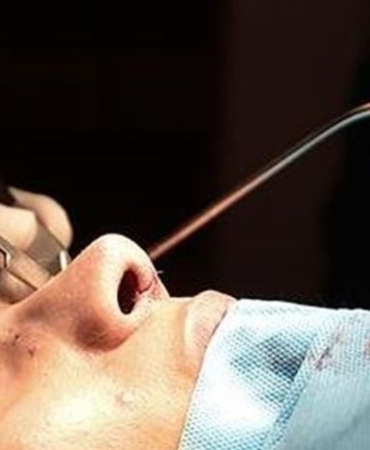 Rinoplasti: Estetik ve Fonksiyonel Cerrahinin Önemi