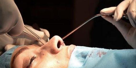 Rinoplasti: Estetik ve Fonksiyonel Cerrahinin Önemi