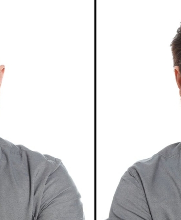 Saç Dökülmesine Çözüm: Yeni Serum Devrim Yaratıyor!