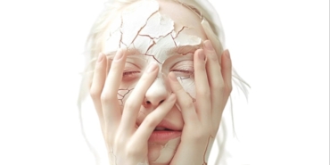 Stres Cildinizi Tehdit Ediyor: Uzmandan İpuçları!