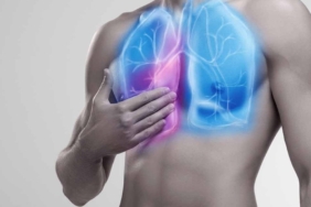 Doğal Beslenme ile Akciğer Sağlığını Güçlendirin!